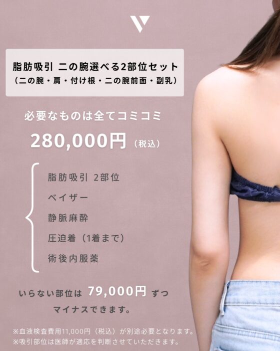 【大阪】井上Dr 7月症例モニター脂肪吸引