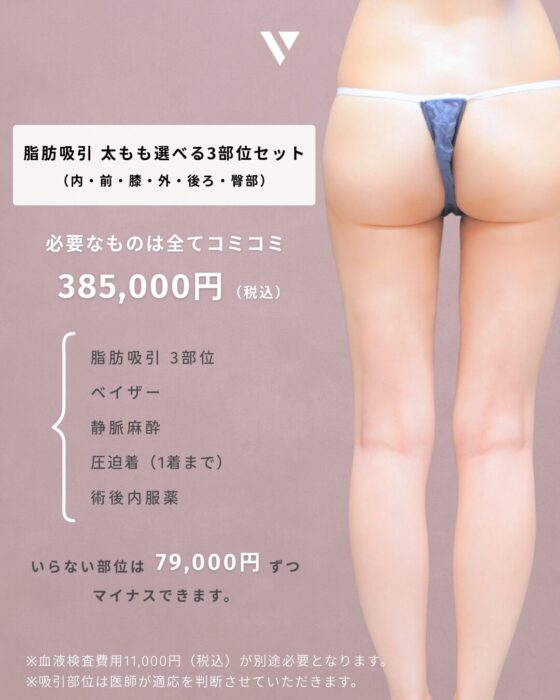 【大阪】井上Dr 7月症例モニター脂肪吸引