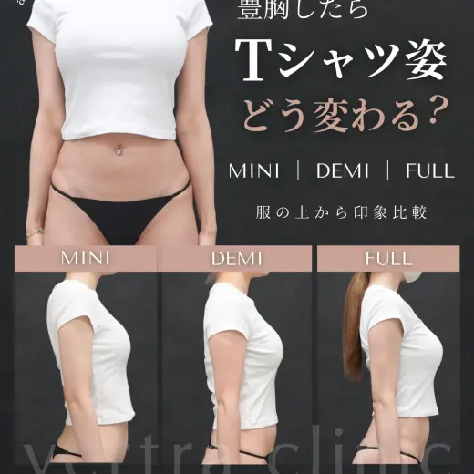 豊胸したらTシャツ姿はどう変わる？