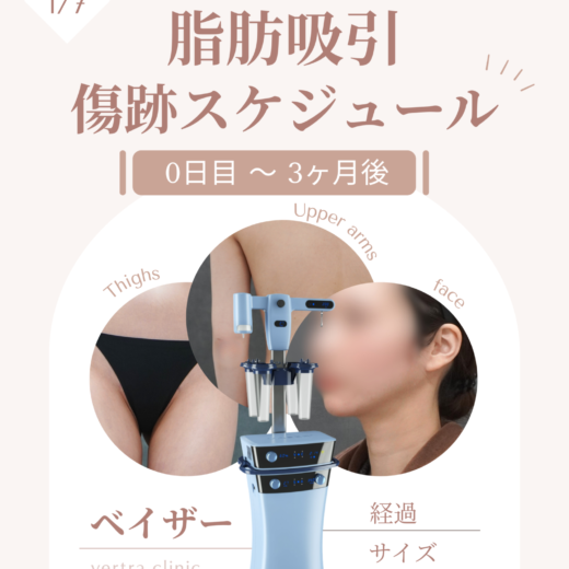 脂肪吸引の傷跡はどこ?太もも・二の腕・顔の位置と術後3ヶ月までの経過を症例で解説