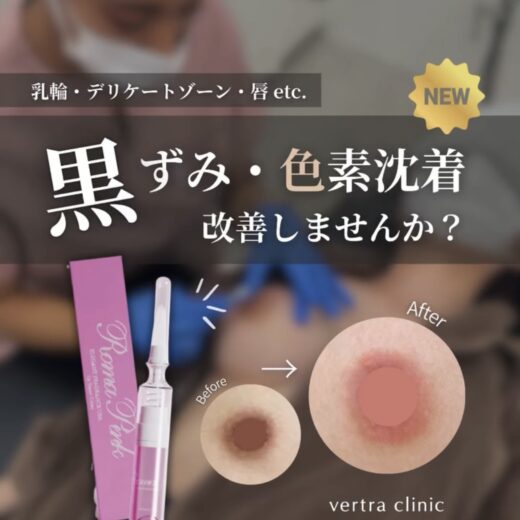 ローマピンクとは?バストトップや唇の黒ずみを改善させ、理想のピンクへ